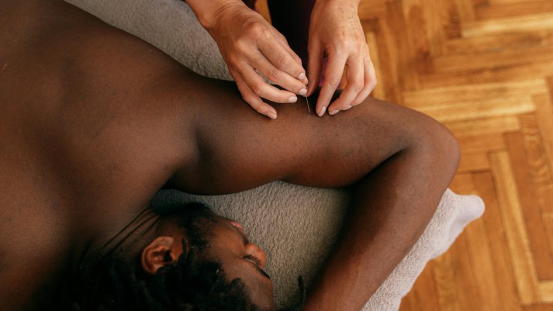 Dry needling care in Vancouver, Washington